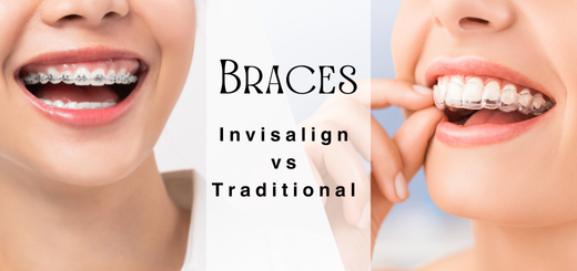 Invisalign vs Traditional Braces